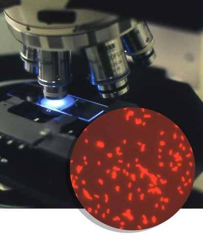 microscope, slide and enlarged microbes